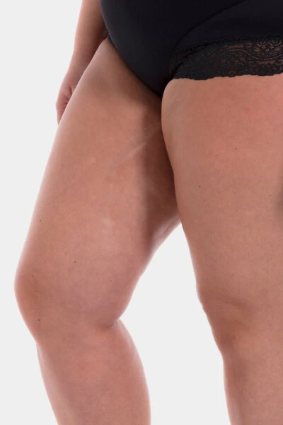 Alternative view of Magic thigh sili